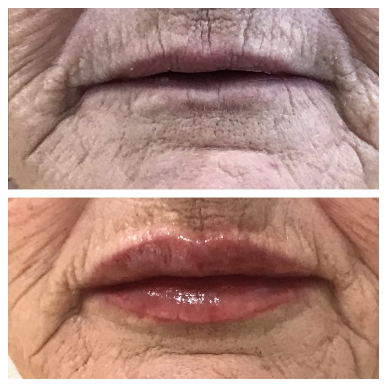 4C7C6968-FCEB-4F49-8C79-C952768C4758 Lip blush. Creates flawless shape and colour